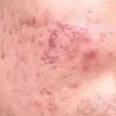 ʼ���޷�����Ķ�ӡ ������󼤹����ı䵭��