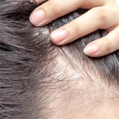 �ҵ�ֲ�������� ��ͷ���䳤��Ϳ��Ը�Ư��������