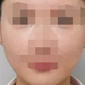 �沿����ռ� ���¸е��沿��ñ���