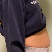 ���ּ�֬�� ���ֵ����ı������Ư��