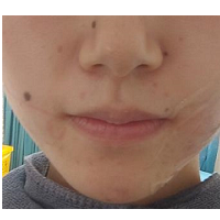 ȥ�� ��������Ƥ�����ɳ�