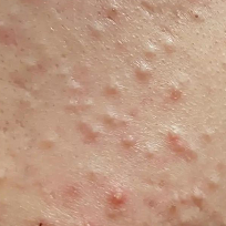 �����ӡ���������˶�������