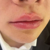 ������ᴽ�ռ� չ���޾��ջ�