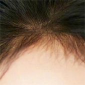 ���˷�������ֲ�� ��ͷ������С�˺ܶ�