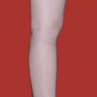 �Ȳ���֬���ҵ��ȱ�ø���������