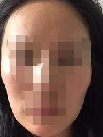 �����沿֬�����������������