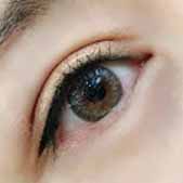 ���۽��ܵ�˫��Ƥҽ�� ������