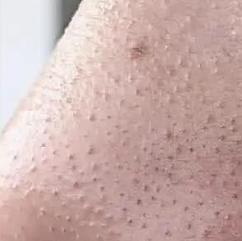 �����ͷ��ë���ҿ��Լ�������˳�۶���