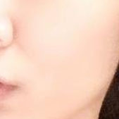 ����֬���沿����ռ� �Ե����������