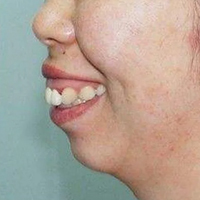 ����ؽ�����������ӵ��һ�����������