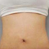 ���˸�����֬�� �Ժ����·�������Сһ�����