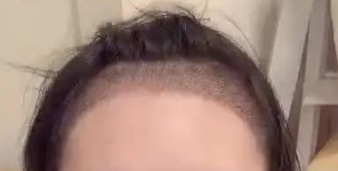 �����ߵ�ֲ�� ���ڿ��������ҵĴ�������