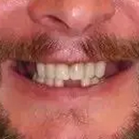 ����ȱʧ  ����ʹ������������