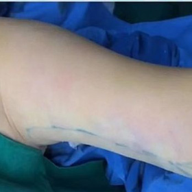 ��֬�����ʵ�ִ��������� ��Ҳ���´�������