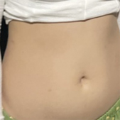 ������֬������� ���ڼ�ֱ���ǻ����ѵ��¼���