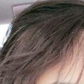 ͷ����ֲ�ռ� ͷ��ïʢ��Ȼ