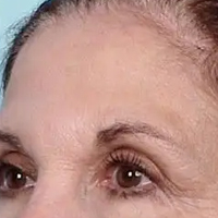 �粨��Ƥ�����ػ�����