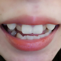 ���ݽ�������Զ�뽹��  ӵ�����������