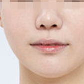 ����ֻ��3��֬������ �����ɾ������沿��֬