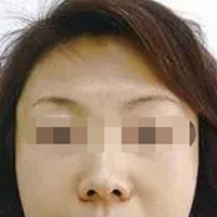 ��������Ӧ���ڣ�ֻ�����ոġ�    �沿�����������»������