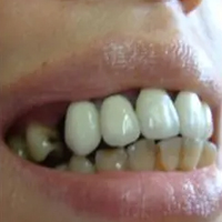 ���˿�����    ��΢Ц����