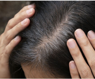 ������̫�߾����ѽ���ֲ���󷢼��߱����