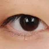 ��˫��Ƥ������һ���������� ȥҽԺ������ؼ��