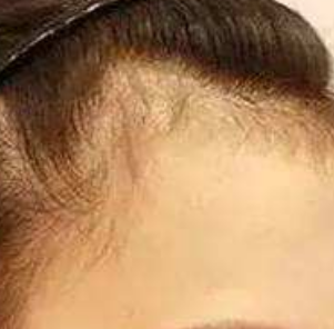 ֲ����ı��˾��������ѵ�٩�ķ�����