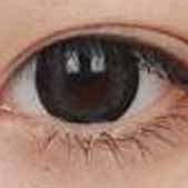 ˫��Ƥ�����һ�����µ�ʱ�� ���Խ���ѡ������ҽԺ