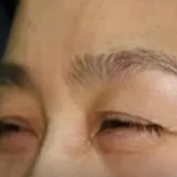 �۲�����   ���ĵ������ºۼ�