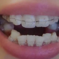 �����ݽ���   �����ɱ�֮��