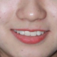 ���ݽ���  �������ӵ������