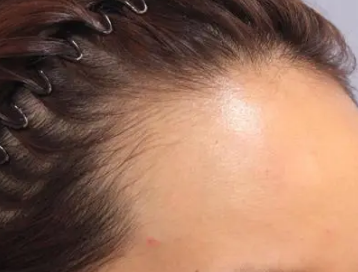 ֲ�����ڸ��������᧿�Σ�ķ�����