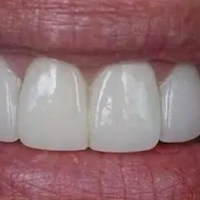 ���˿�����  ����������