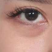 ����+�����ͷ�һ���  Ƥ����û�������κκۼ�