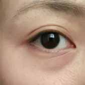 ȥ���۴���7������ �۴��Ѿ��ָ�����ʣ�޼���