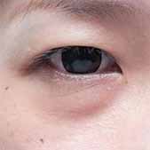 �����Ŵ����ص��۴� ���ڵõ��˸���