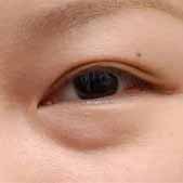 �����Ĳ�����4���Ƴ� �۴�������ʧ������