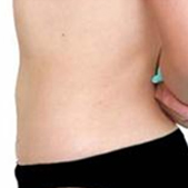 Ϊ��ӵ�������ĺ����� ����Ȼ��Ȼ��ȥҽԺ����֬