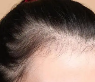 ֲ�����ҵķ����������ܿ�������