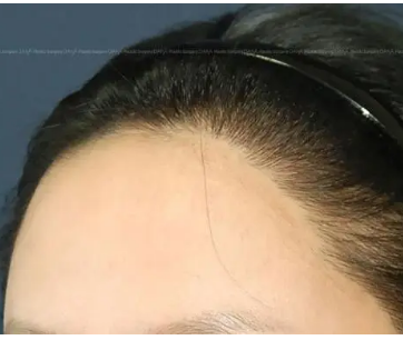 ����֬�������������ǲ������Ķ�ͷ