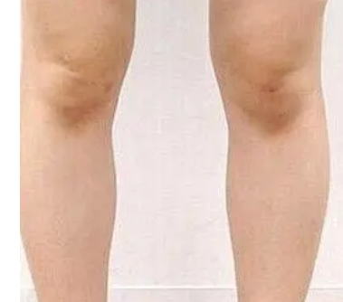 ֬�����������ҵ�O���� �������������˹�Ŀ�࿴��