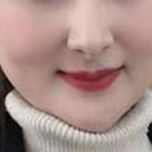 ���������ռ� Ƥ��״̬����ǲ��Ǻ���Ľ