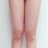 ���˴�����֬��ȥ�������� �����Ȳ����˺ܶ�