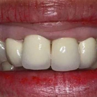 ������������   ���������ָ�������