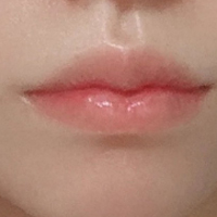 촽̫񲻺ÿ ҽÿܶ