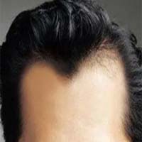 ֲMͷ