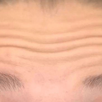 ҽķ ʱµ̧ͷƱʧ