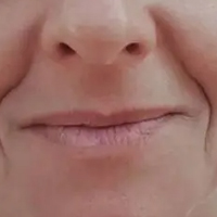 꼪 о˺ܶ