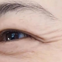 ȥҽ Գϵβʧ